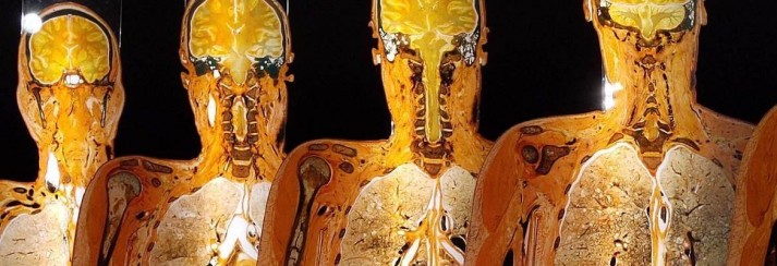 Exkurze Plastinarium
